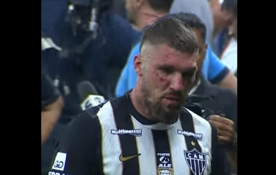 Χάος στη Βραζιλία: Επτά παίκτες επιτέθηκαν στον Λιάνκο (VIDEO)