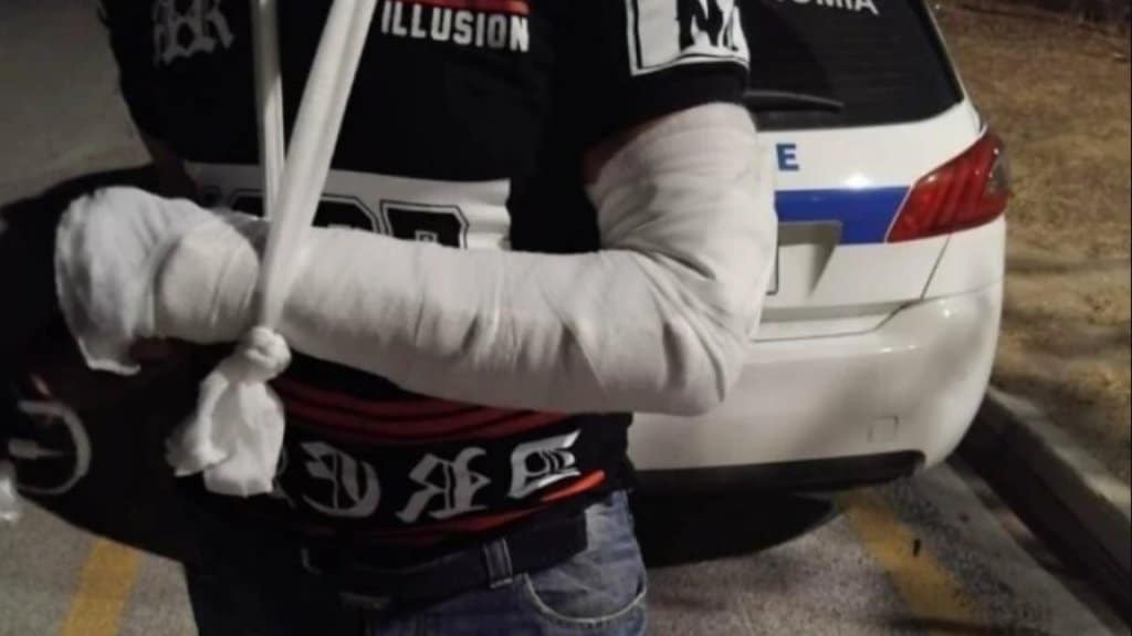 Ρομά στον Βόλο έσπασε με σκουπόξυλο το χέρι ταξιτζή!